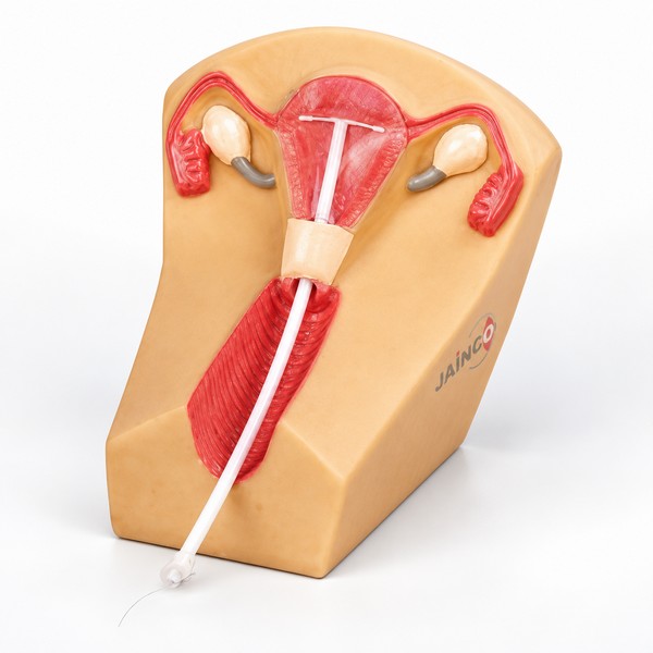 IUD Training Model